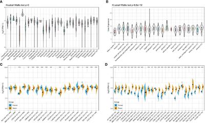 Comprehensive Pan-Cancer Analysis Confirmed That ATG5 Promoted the Maintenance of Tumor Metabolism and the Occurrence of Tumor Immune Escape